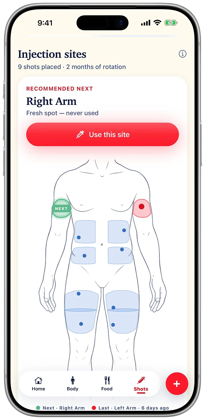 Injection sites: nine shots placed over two months, and the recommended next site, the right arm, a fresh spot never used.